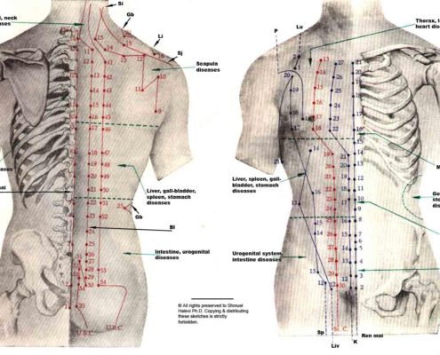back pain