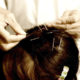 Chinese Scalp Acupuncture